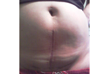 Ů���ʸ�����Ķ�Ƥ �Ҳ��̶�